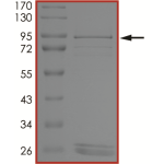EGFR (d746-750 C797G), Active